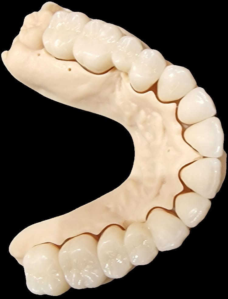 coroana dentara avl32