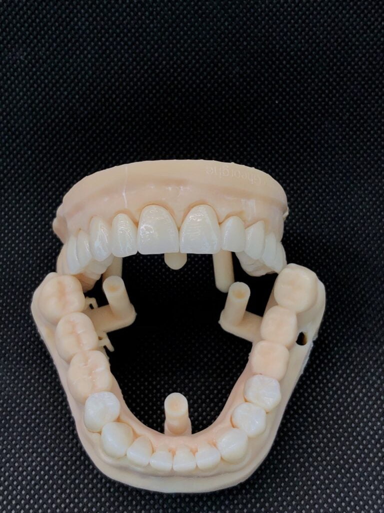 Coroane si fatete zirconiu estetic avl32